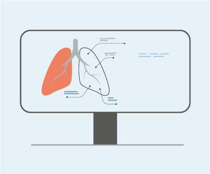 Interstitial lung disease